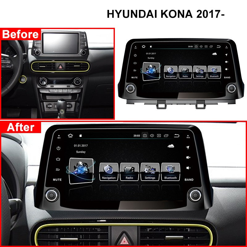 Android 10 for Hyundai Encino Kona 2017 2018 2019 Car Multimedia Stereo Player No DVD Car Radio GPS Navigation Carplay Head Unit